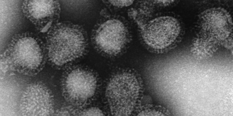 Picture of H3N2 Influenza A virus